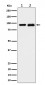 CSDE1 Antibody